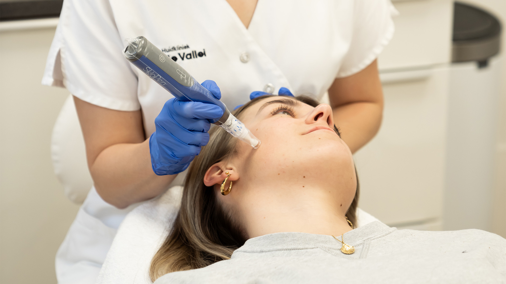 SkinPen behandeling