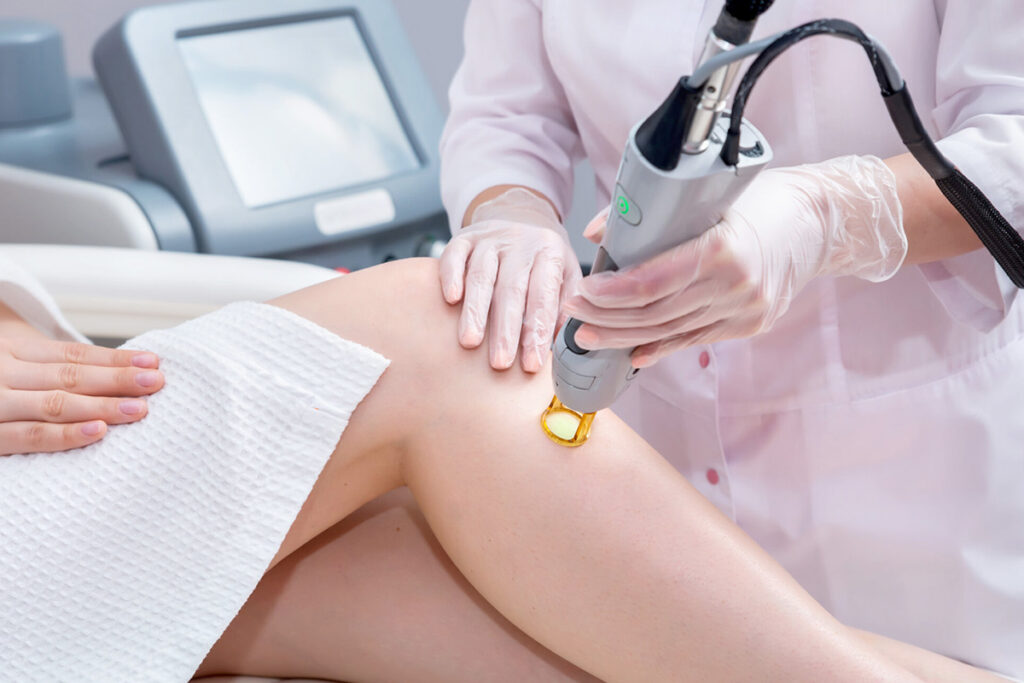Behandeling soorten striae